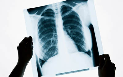Medidores multifunÃ§Ã£o e para levantamento radiomÃ©trico em raios X mÃ©dico e odontolÃ³gico, fluoroscopia, mamografia e CT